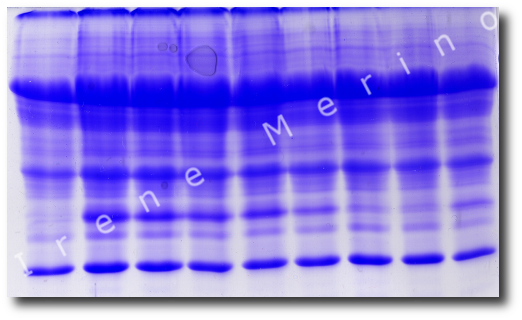 Eletroforese unidimensional SDS-PAGE